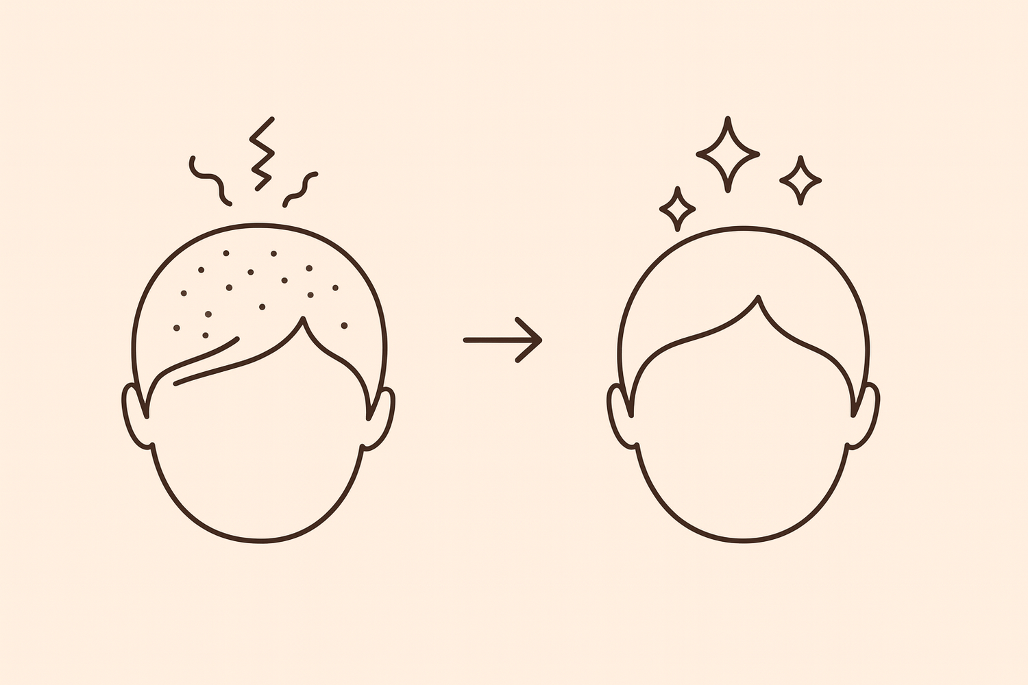 Full HD before/after hair transformation with background #F9E8DC and brown clipart #4D3E32